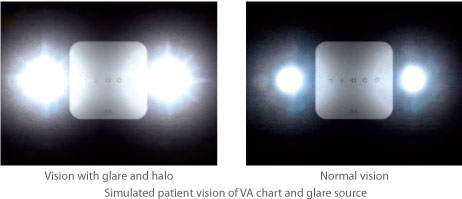 >VA measurement with glare test 